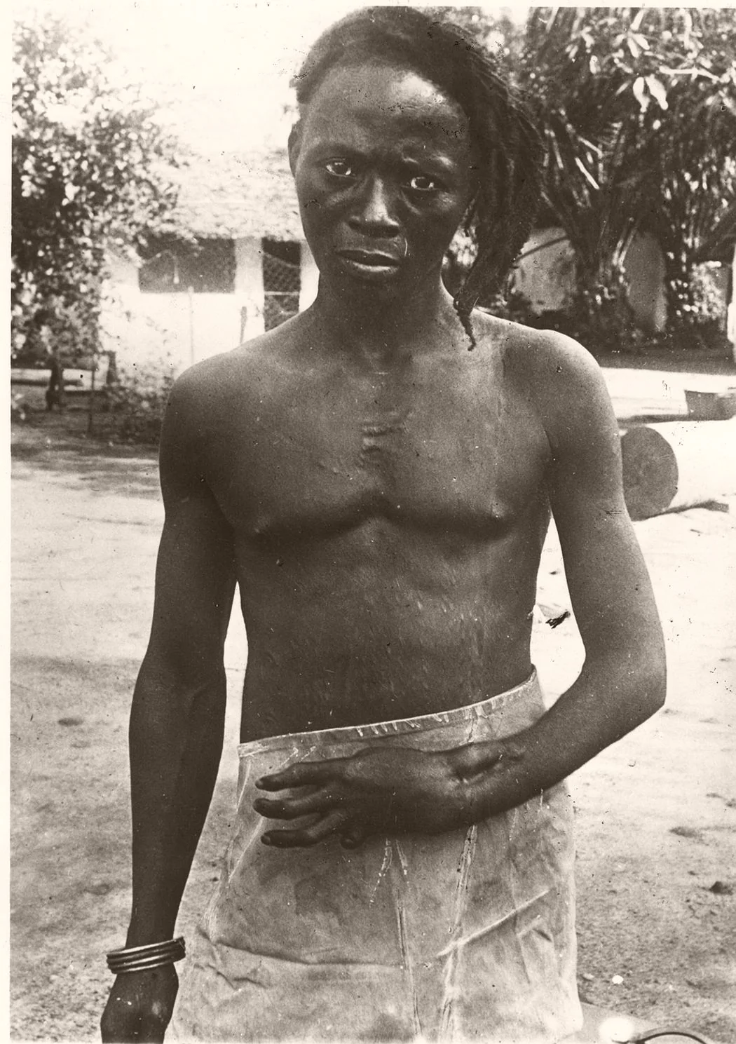 Photo of a Rubber plantation worker of the Belgian Congo with sniper wound on his wrist. Taken by Anti-Slavery english missionary Alice Seeley Harris, circa 1898 [1050×1489]
