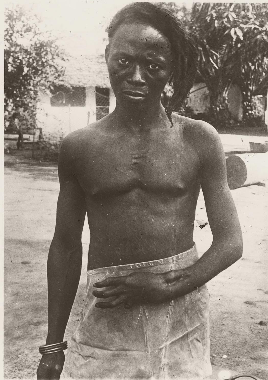 Photo of a Rubber plantation worker of the Belgian Congo by Anti-Slavery english missionary Alice Seeley Harris, 1898. [1050×1489]