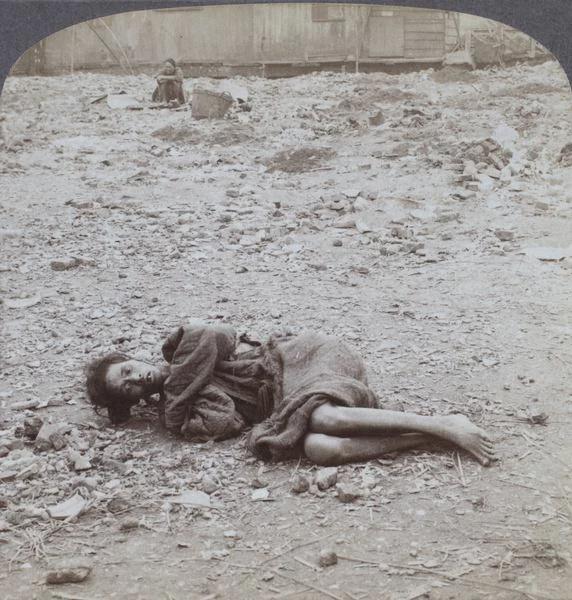A man in the “Dying Field”, a small plot of land in Canton, China, where the sick and poor could go to die undisturbed, photo by James Ricalton, 1900. [572×600]