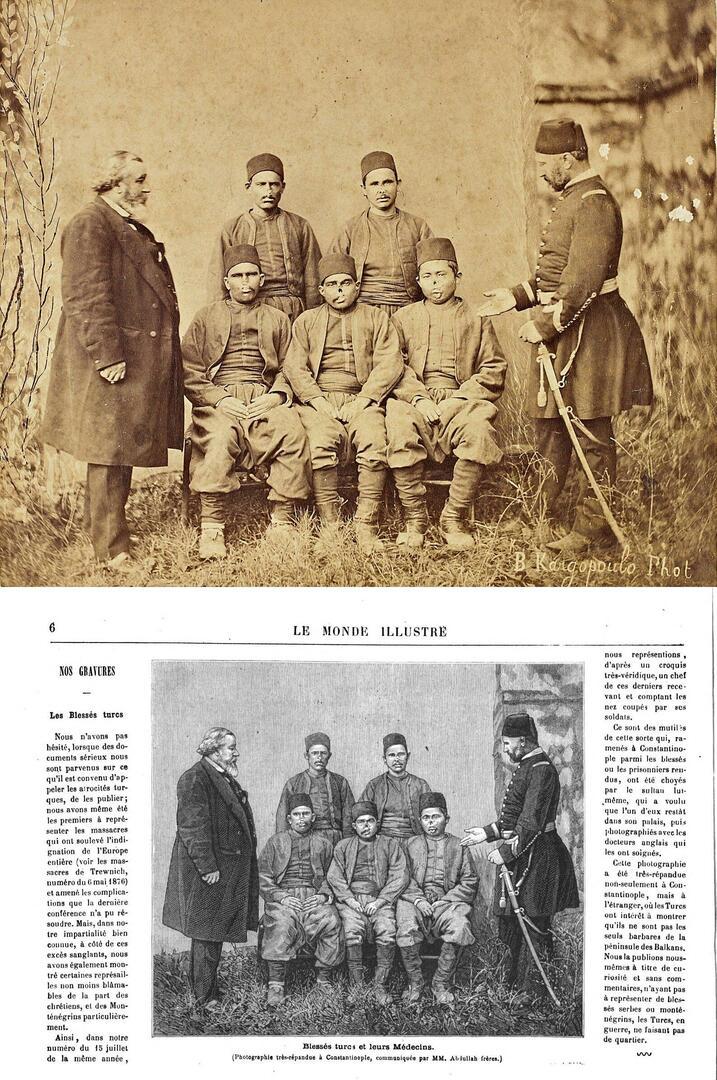 Ottoman-Turkish soldiers whose noses and ears were cut off by Bulgarian soldiers during the Russo-Turkish War. (1878) [1588×2392]
