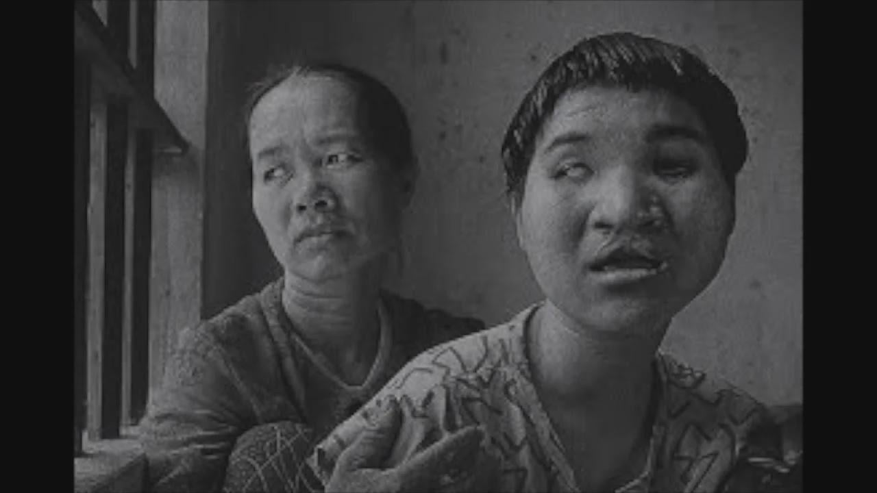 A Vietnamese woman deformed by American chemical warfare August 27, 2006 [1280x720px]