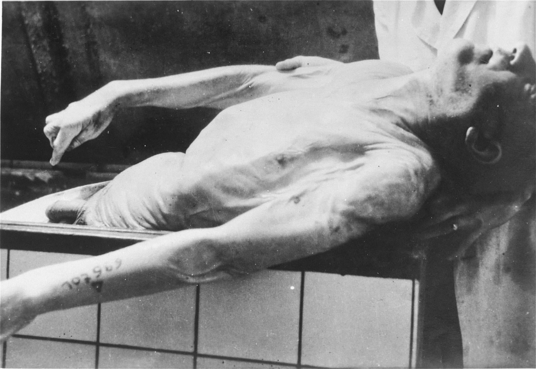 The body of Jewish prisoner Menachem Taffel, his identification tattoo still visible on his forearm, after he was murdered at the Natzweiler-Struthof concentration camp. His body was subsequently transported to the Strasbourg University Anatomical Institute, December 1944. [1745 × 1200]